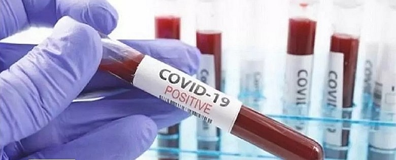 Hơn 6,5 triệu người tử vong do COVID-19 trên thế giới Hơn 6,5 triệu người tử vong do COVID-19 trên thế giới
