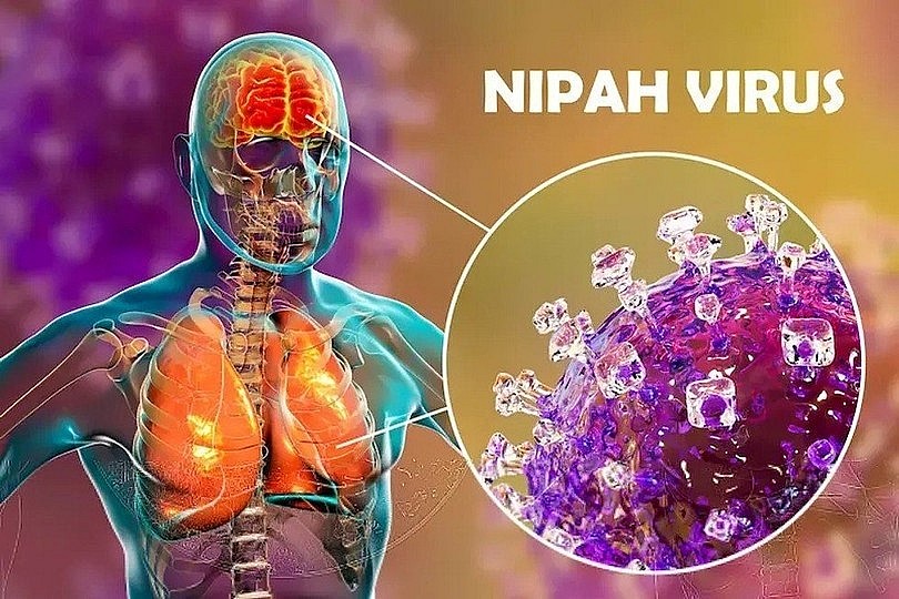 Bộ Y tế hướng dẫn giám sát và phòng bệnh do virus Nipah ở người Bộ Y tế hướng dẫn giám sát và phòng bệnh do virus Nipah ở người