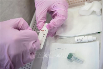 Bộ xét nghiệm giúp phát hiện kháng thể chống virus SARS-CoV-2 có giá 1 USD