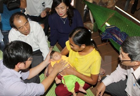 Thông báo mới nhất về trẻ đầu nhỏ nghi do Zika tại Việt Nam